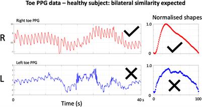 Advancing PPG Signal Quality and Know-How Through Knowledge Translation—From Experts to Student and Researcher